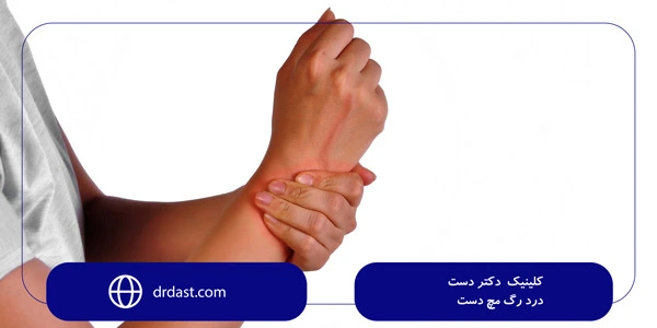 drdast.com-Wrist-vein-pain