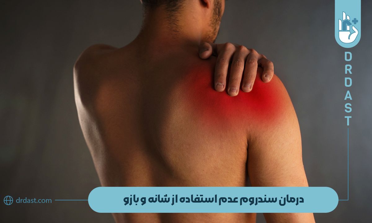 درمان سندروم عدم استفاده از شانه و بازو
