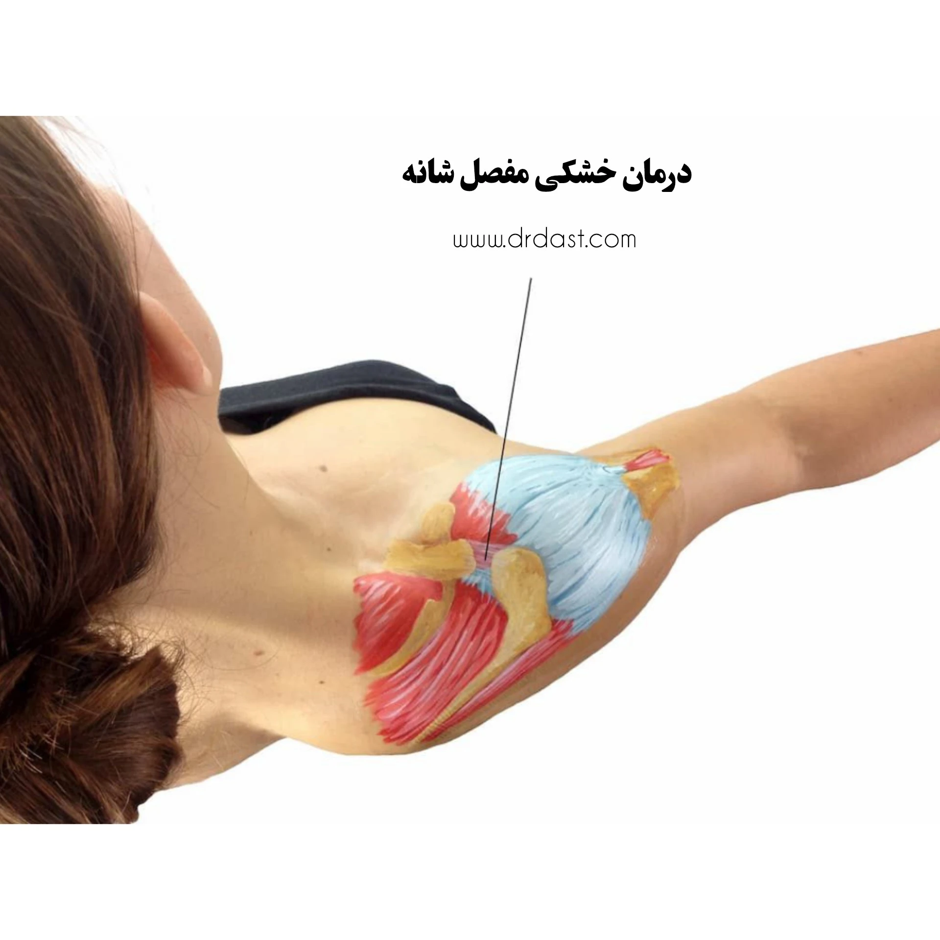 Treatment-dry-shoulder-joint