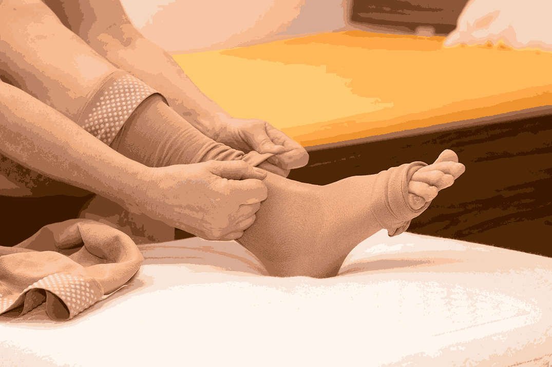 جوراب واریس بعد از عمل دیسک کمر