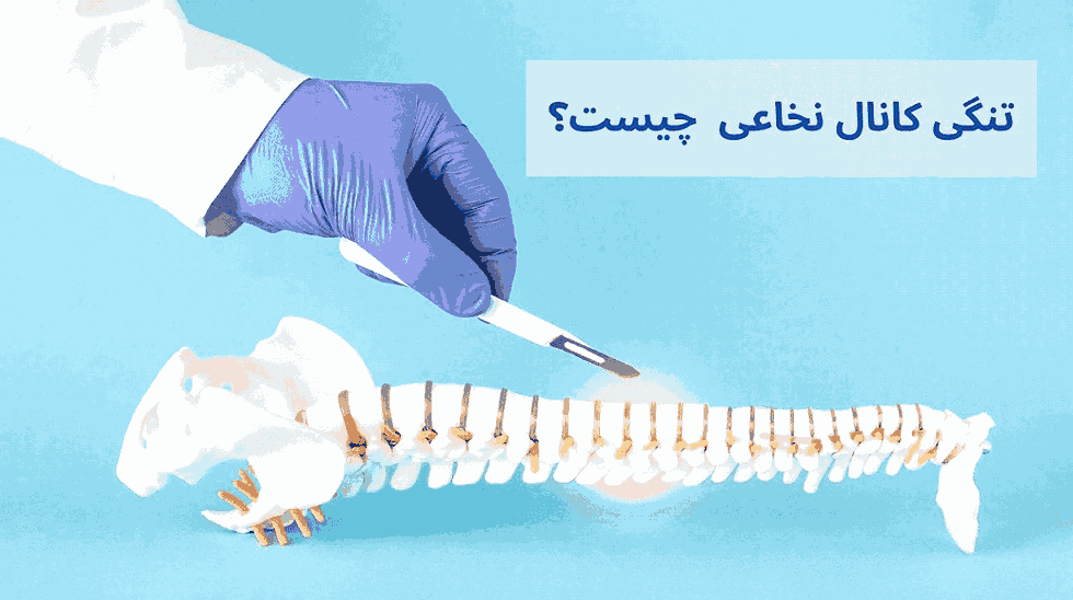عواقب خطرناک! اگر تنگی کانال نخاعی درمان نشود چه میشود؟