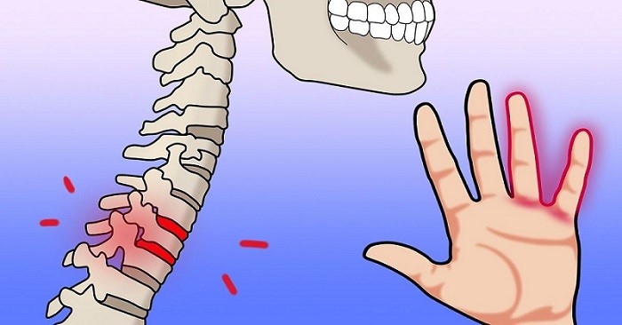 بی حسی دست، علائم و درمان آن